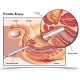 cirurgias-de-postectomia-cirurgia-de-fimose-postectomia-cirurgia-de-fimose-postectomia-particular-itaim-paulista