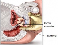 tratamento-urologico