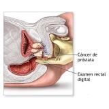 urologistas-consulta-com-urologista-especialista-em-urologia-na-penha-de-franca